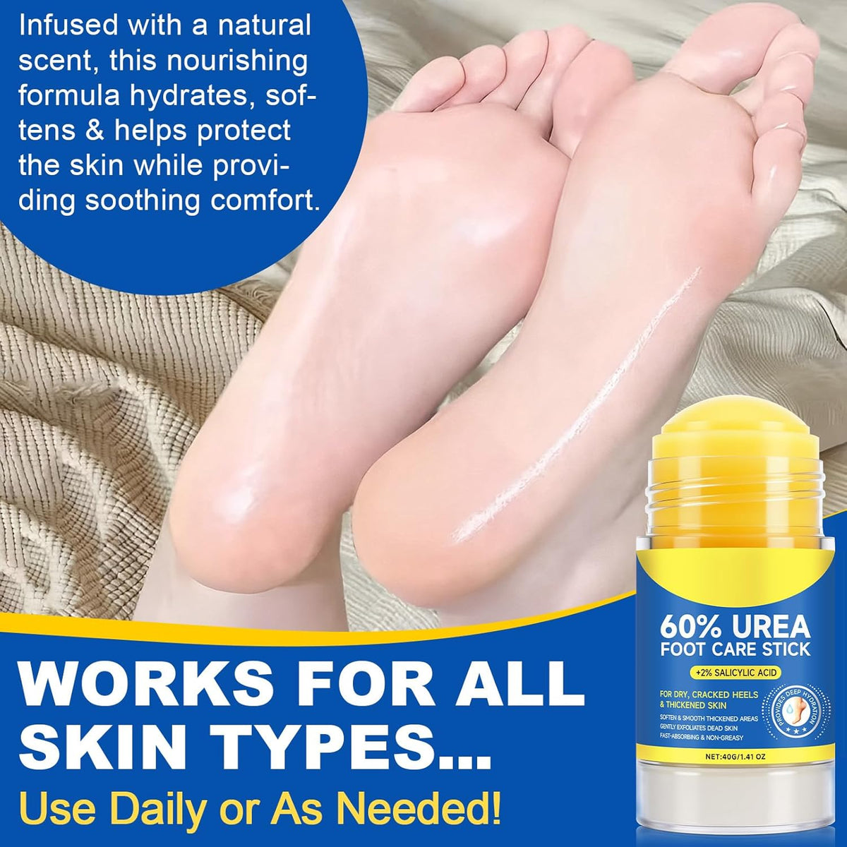 Skiennix Urea Cream Stick - Maximum Strength 60% Urea & 2% Salicylic Acid for Dry Cracked Skin | 1.4oz