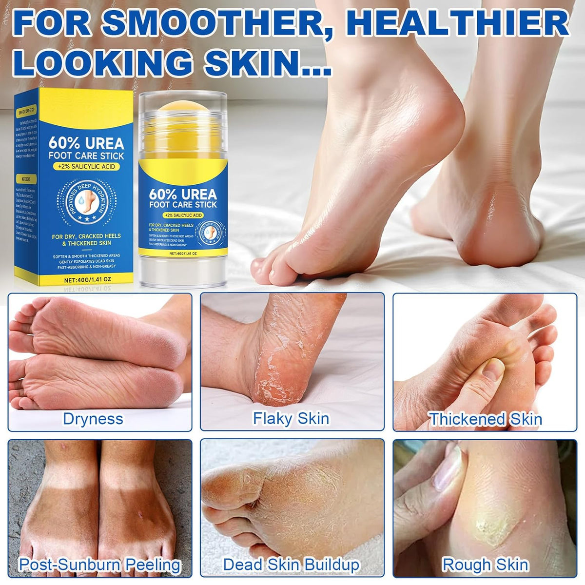 Skiennix Urea Cream Stick - Maximum Strength 60% Urea & 2% Salicylic Acid for Dry Cracked Skin | 1.4oz